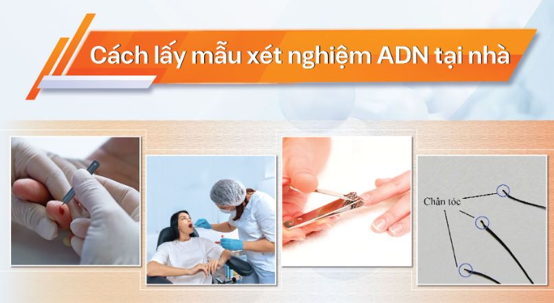 Hướng dẫn thu mẫu vật để xét nghiệm ADN tại Tâm Gia